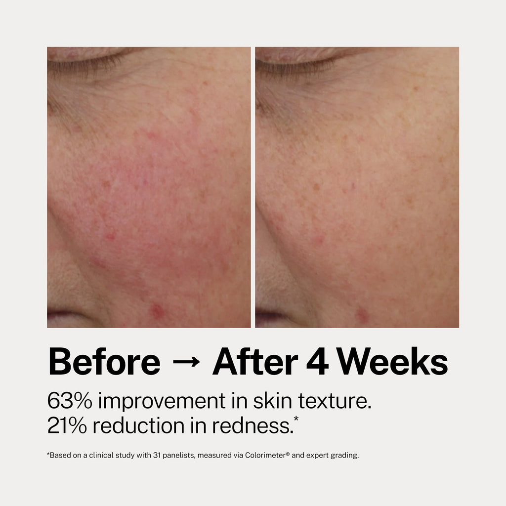 The Catalyst Face Serum