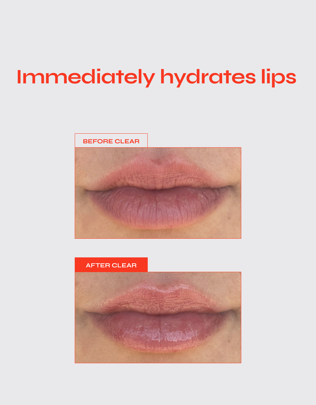 LIP JELLY Hydrating Glossy Peptide Treatment