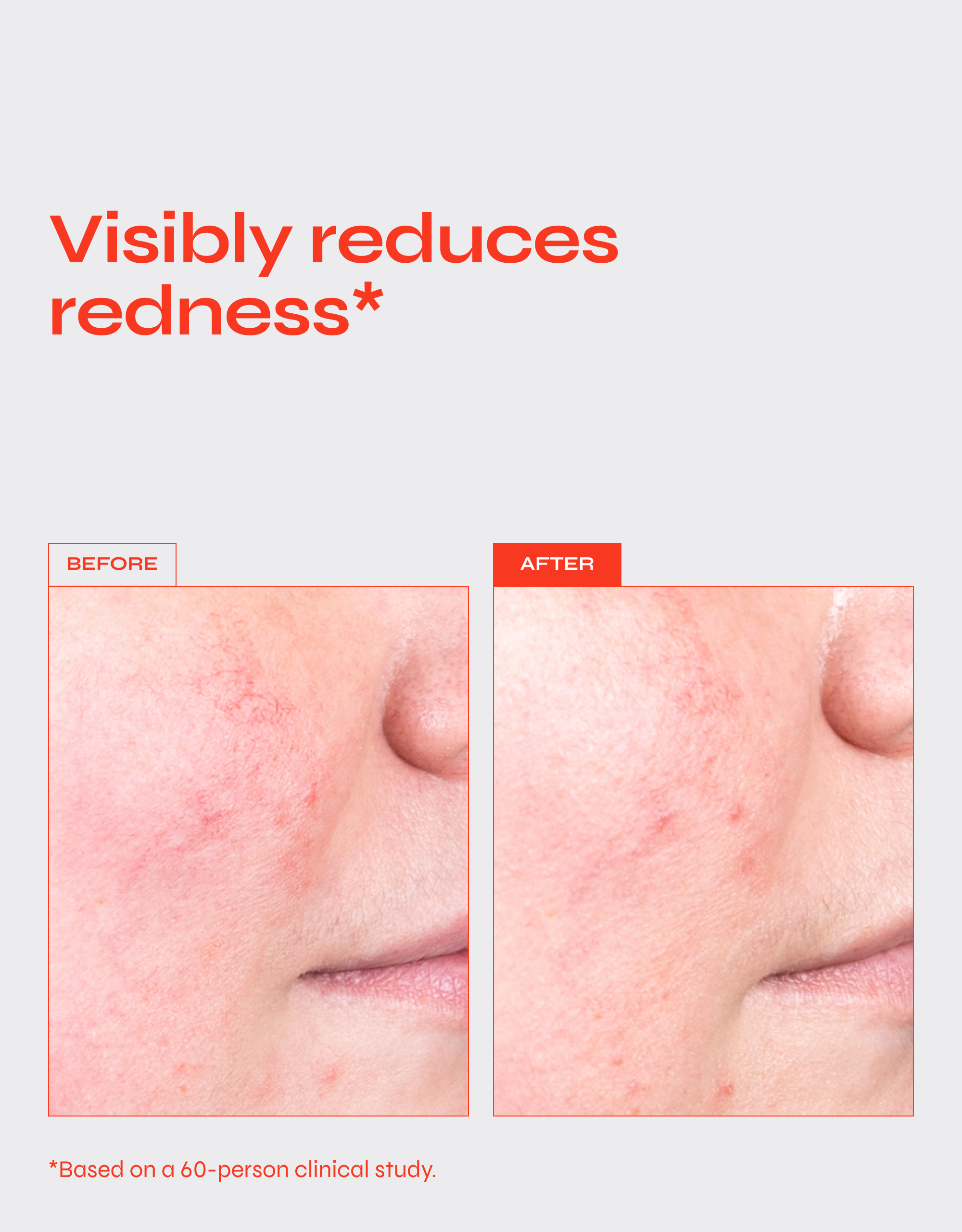 DESTRESS Redness Calming Serum with Vitamin C & Ceramides