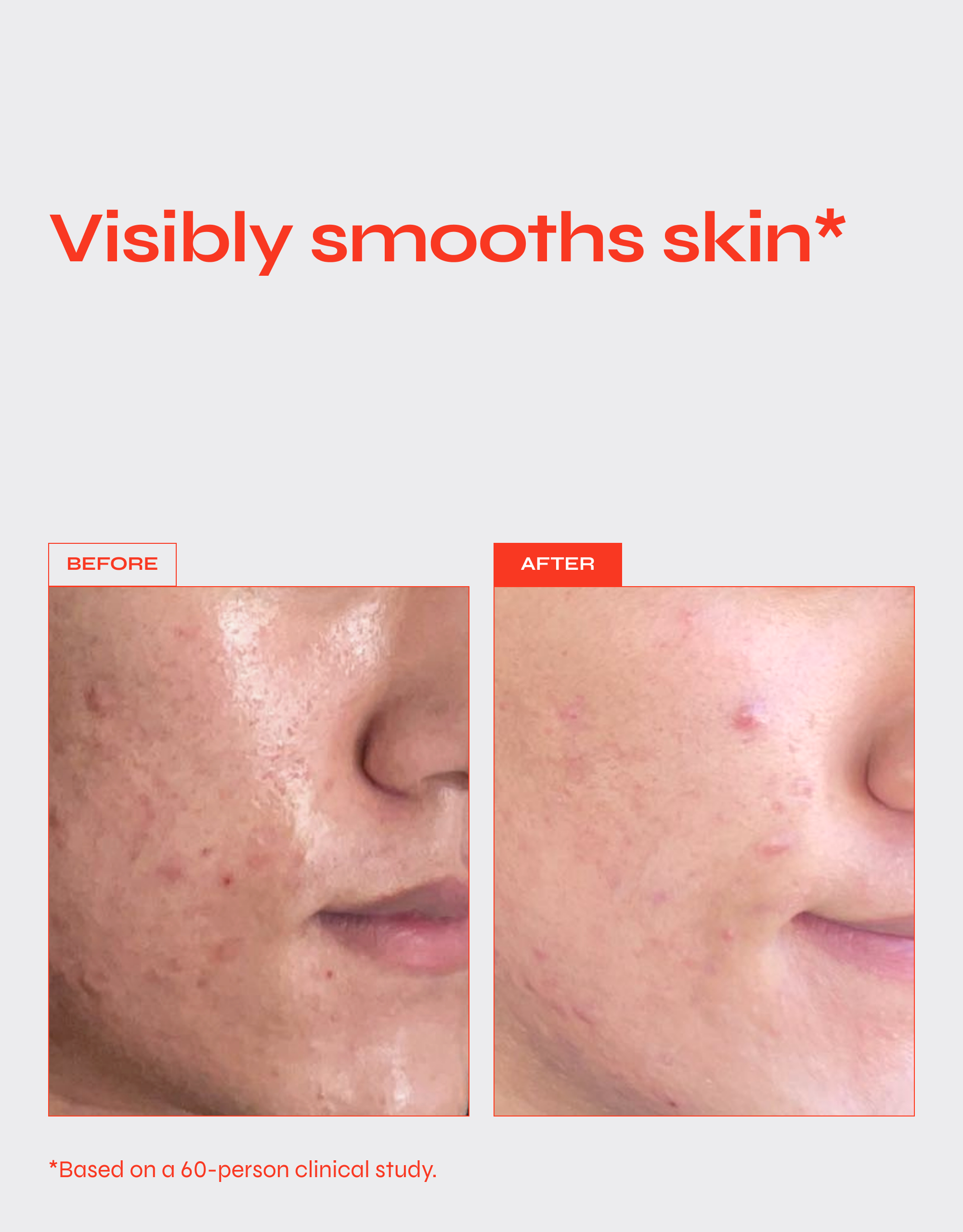 REVERSE 0.2% Retinol Firming Serum for Fine Lines & Wrinkles