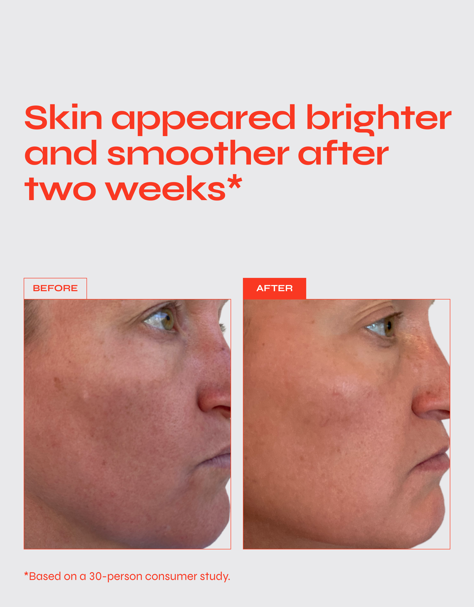 THE BUZZ Brightening Exfoliating Facial Treatment with AHA & BHA