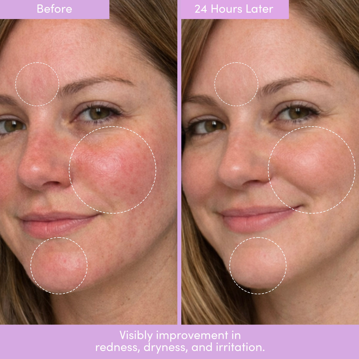 THE PLACENTA FACIAL Dark Spot Serum + Barrier Repair Cream Bundle