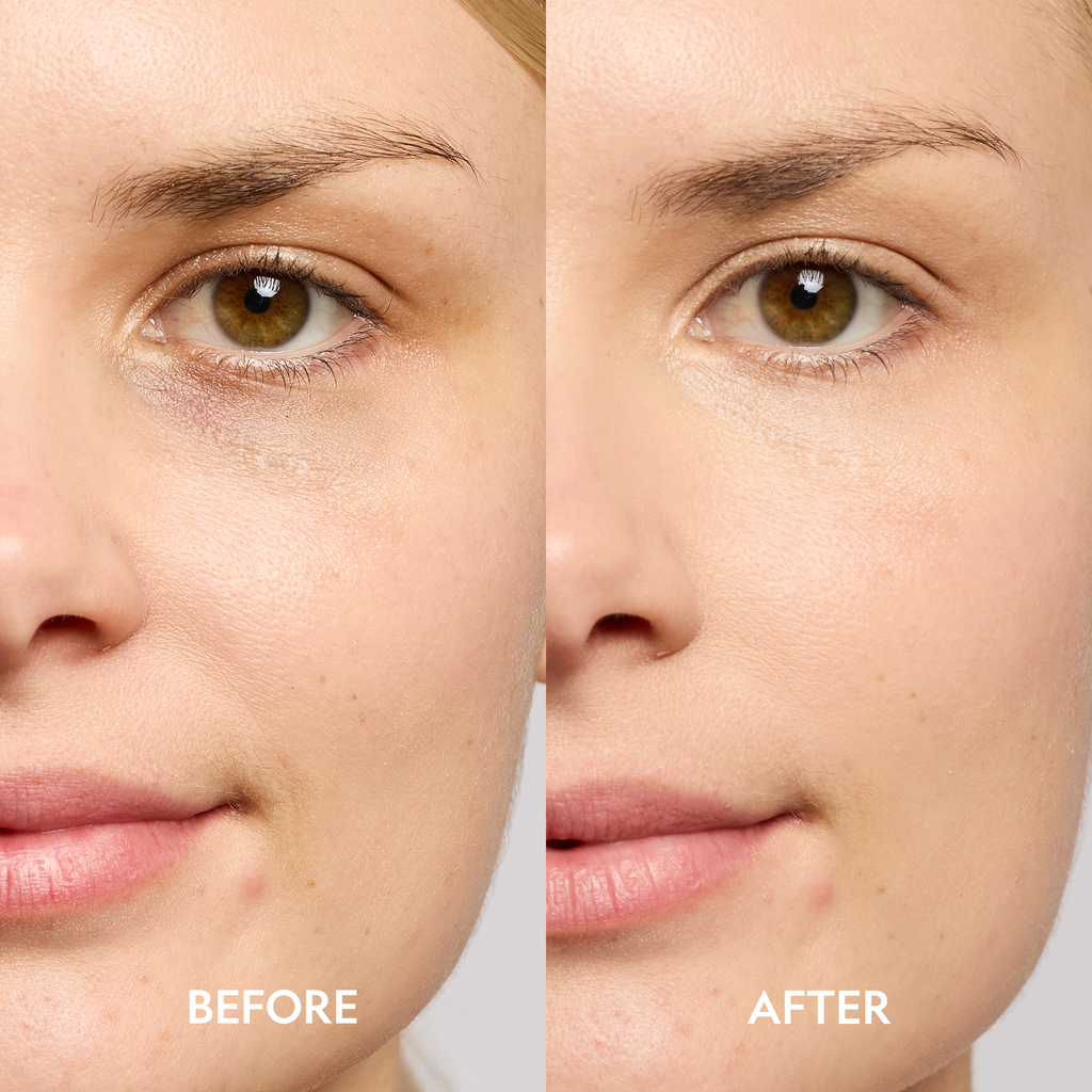 Super Bright Dark Circle Serum Peptide Corrector